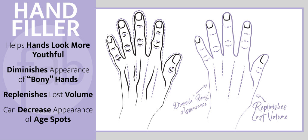 Hand Filler Infograph