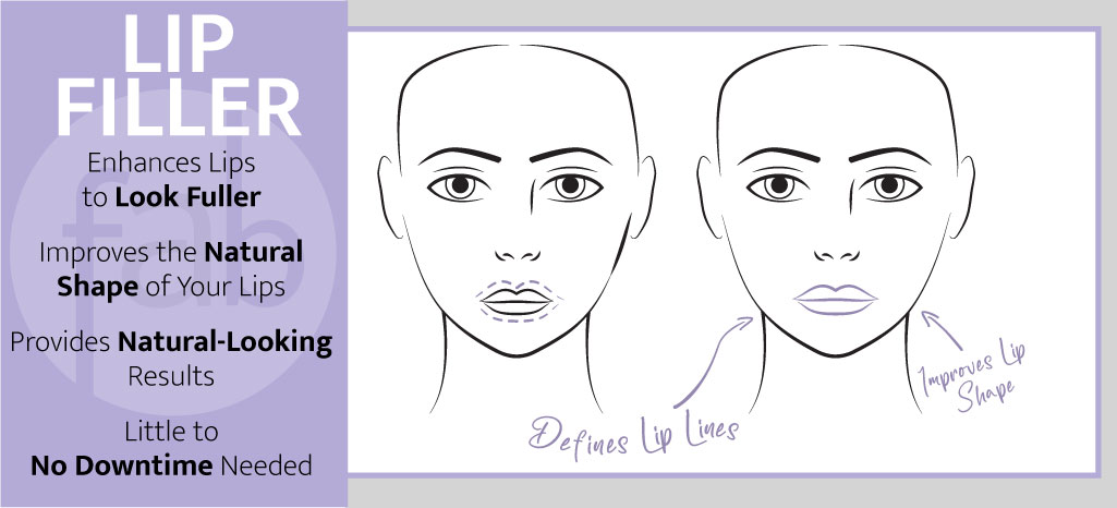 Lip Filler Info Graph