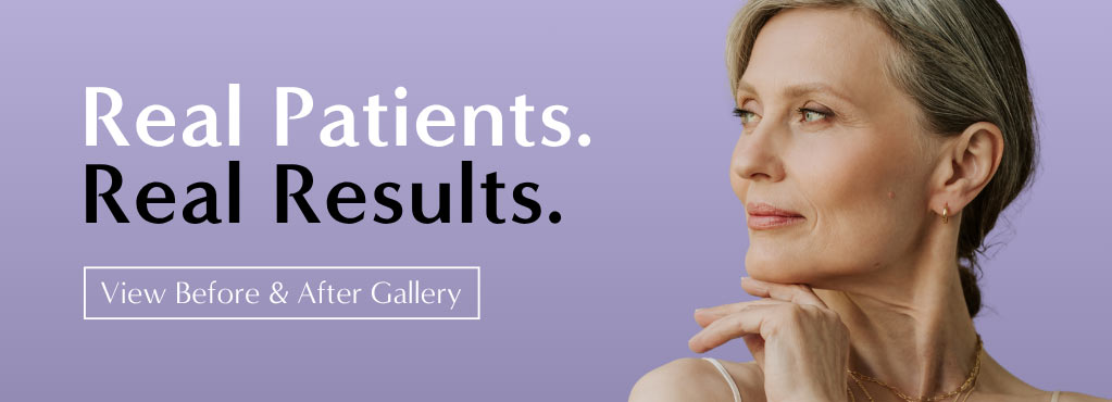 Before & After Gallery